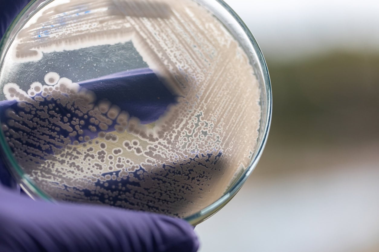 coliform bacteria in well water