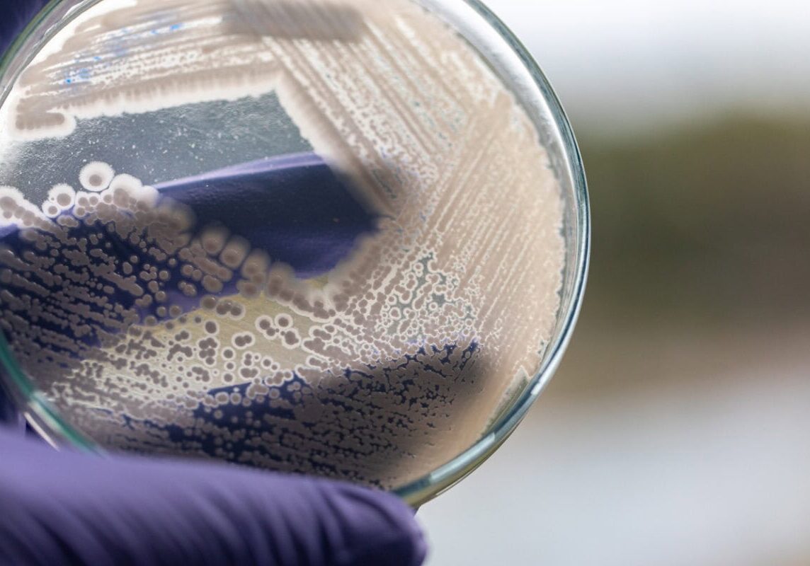 coliform bacteria in well water